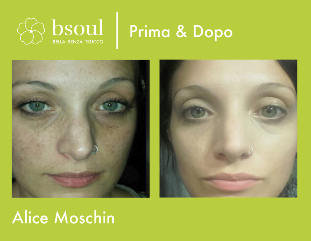 bsoul cosmetici naturali prima e dopo macchie della pelle