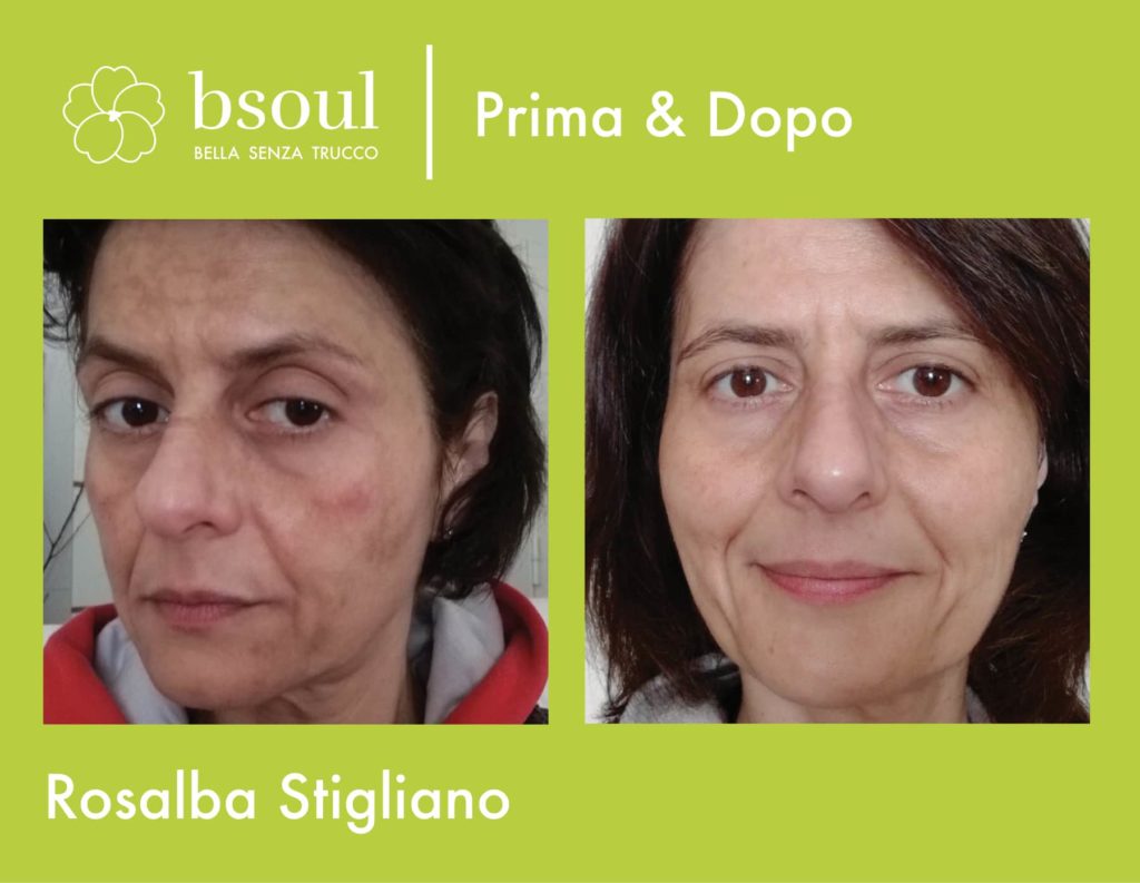Rosalba Stigliano prima e dopo bsoul cosmetici naturali